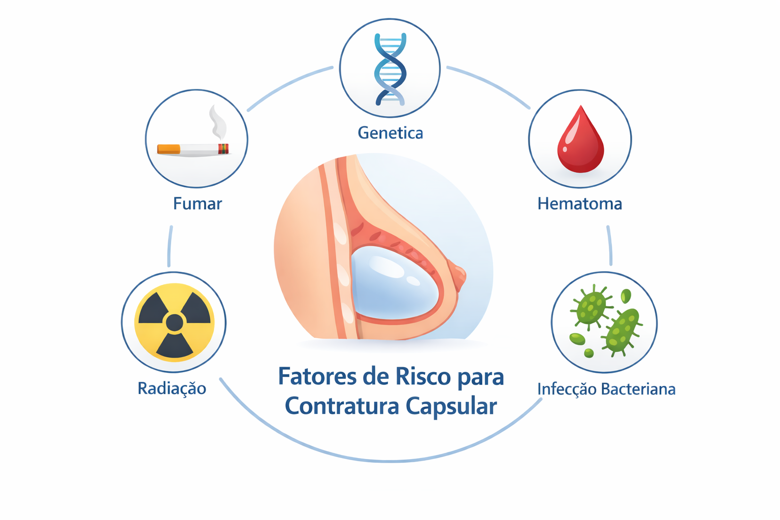 Fatores de risco para contratura capsular