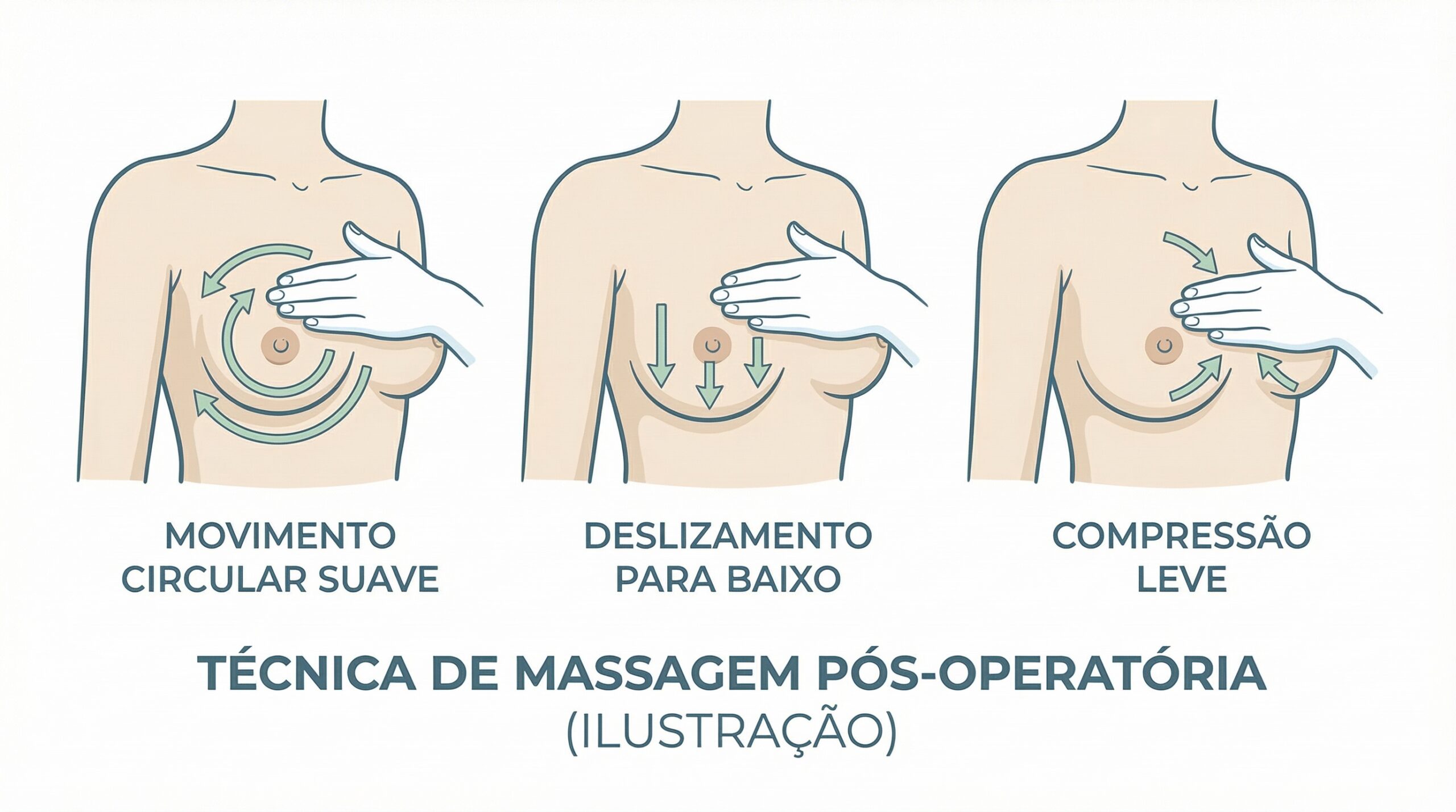 Técnica de massagem pós operatória para evitar contratura capsular